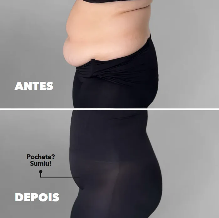 Antes e depois 2